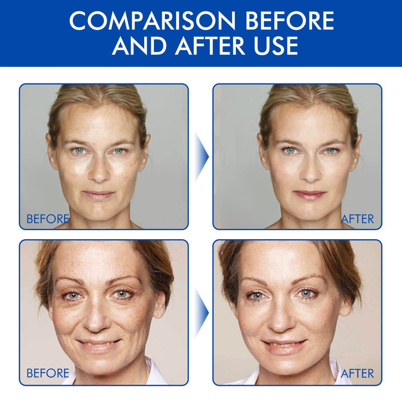 Anti-Falten Botox Gesichtsserum