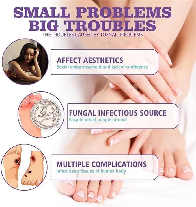 Anti-Pilz Fuß & Nagelspray™ 👣