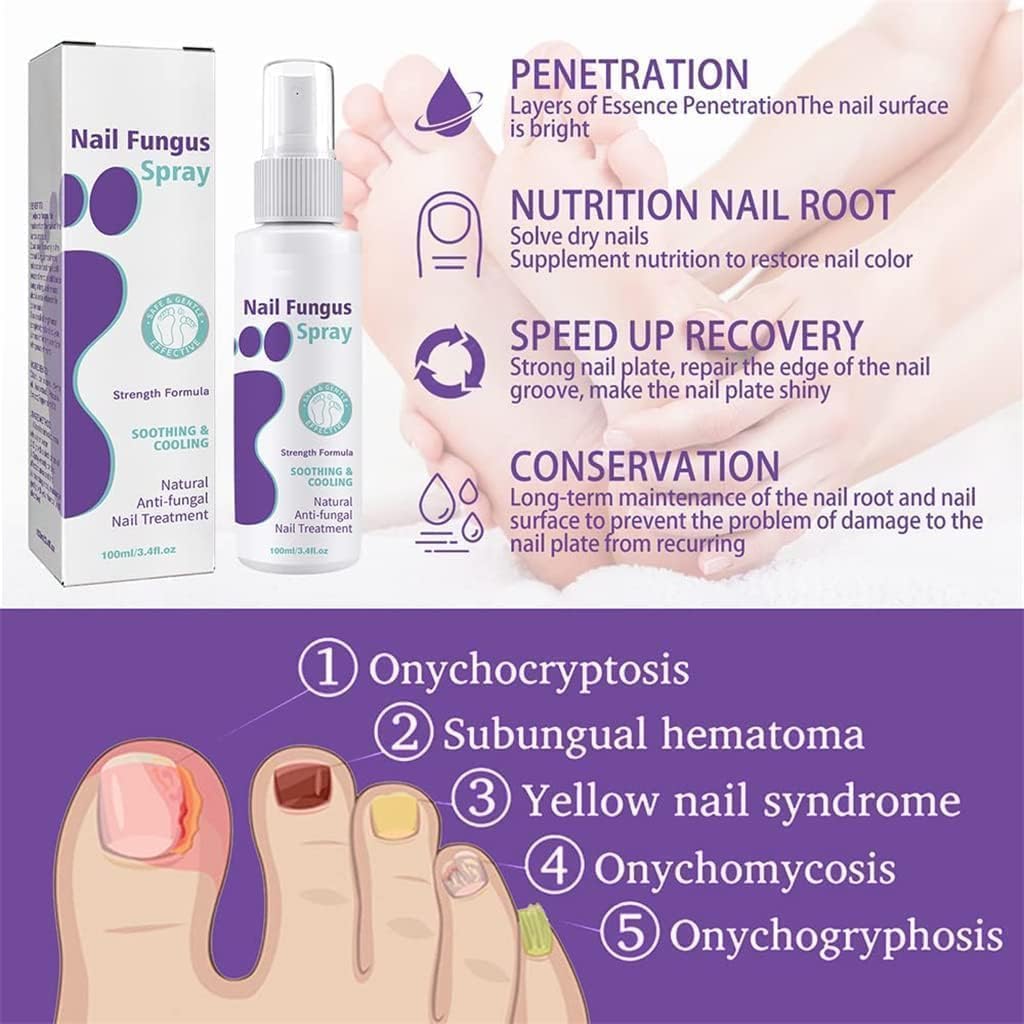 Anti-Pilz Fuß & Nagelspray™ 👣