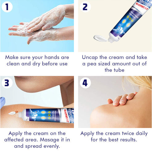 Wart-Remover