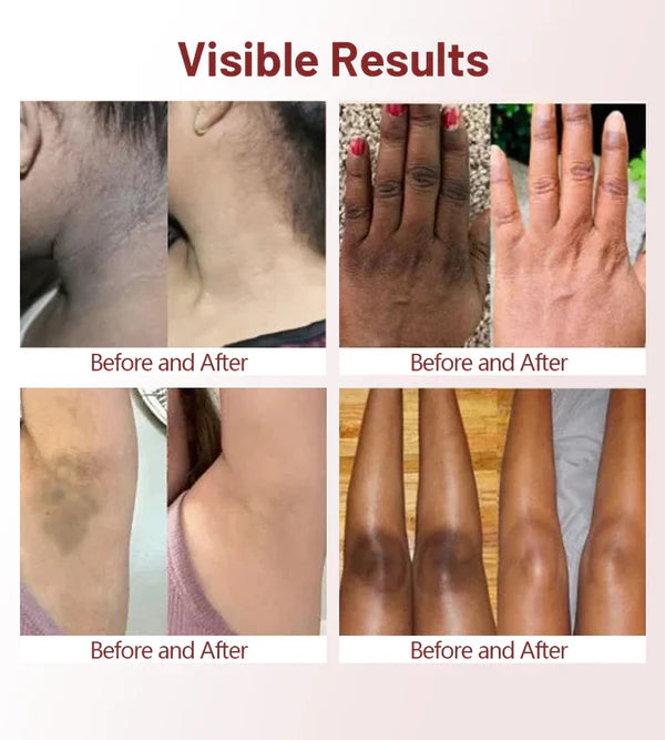 PHANSTA - Körper- und Gesicht Peeling-Gel – Tiefe Reinigung und Feuchtigkeitspflege 50ml