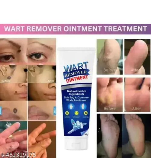 Wart-Remover