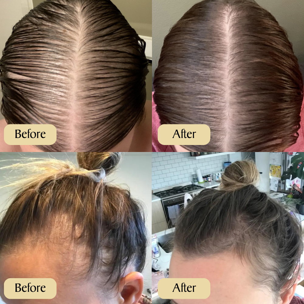 Veganic™ – Natürliches Haarwuchs-Öl