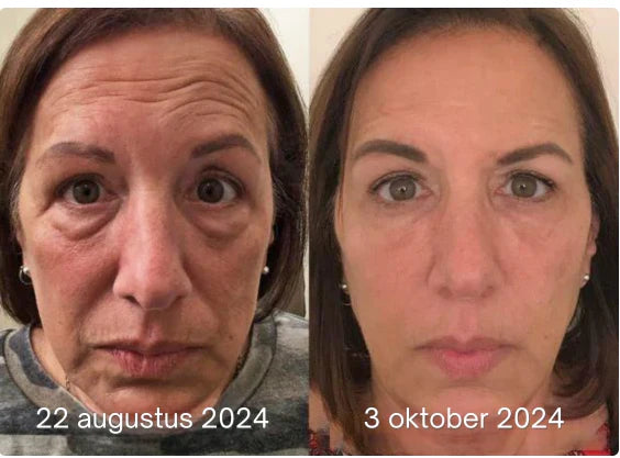 Anti-Falten Botox Gesichtsserum