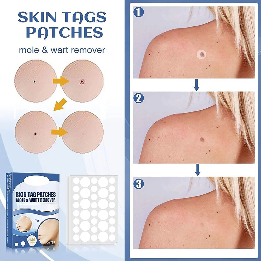 Skin-Tags™