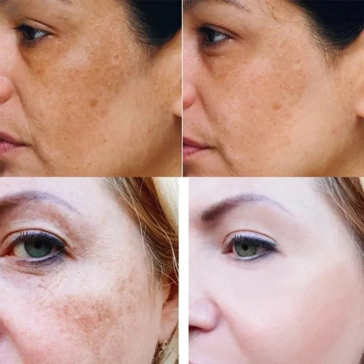 GlowGenix | Kurkuma Dunkle Flecken Aufhellendes Serum