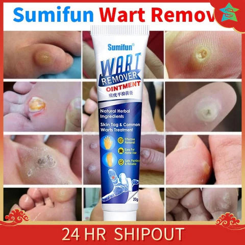 Wart-Remover